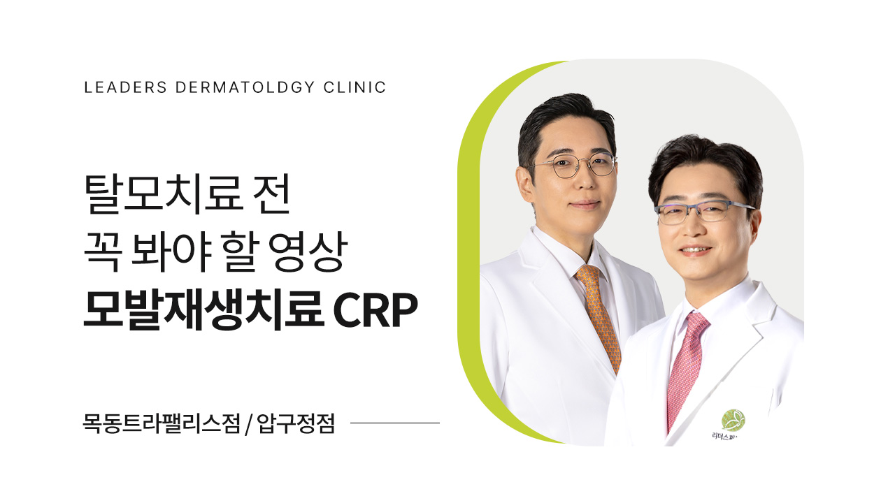 탈모치료 전 꼭 알아야 할 사항은?