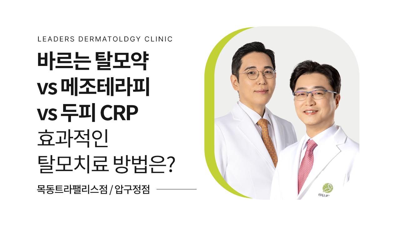 바르는 탈모약 vs 메조테라피 vs 두피 CRP